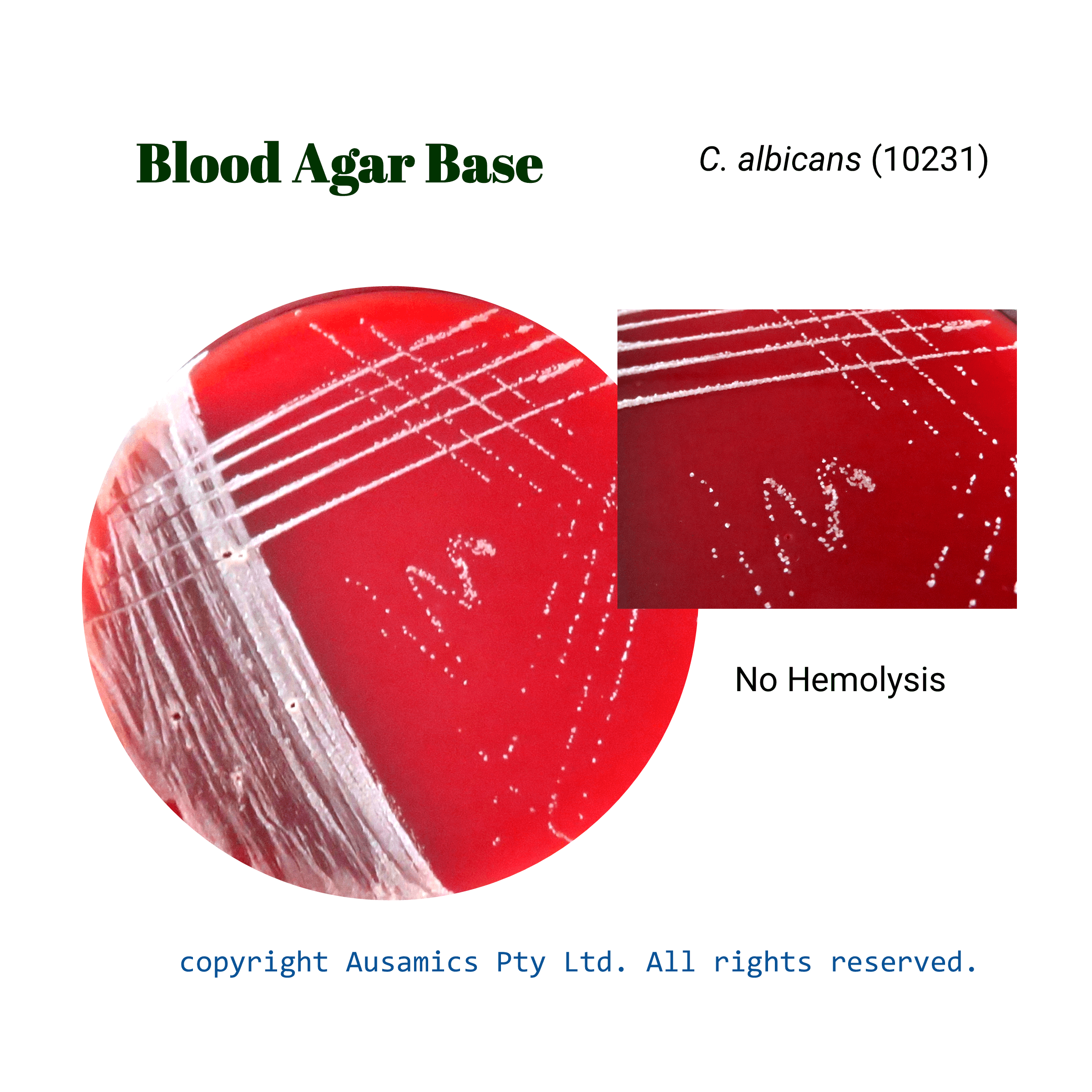 Blood_Agar_Base_Calbicans