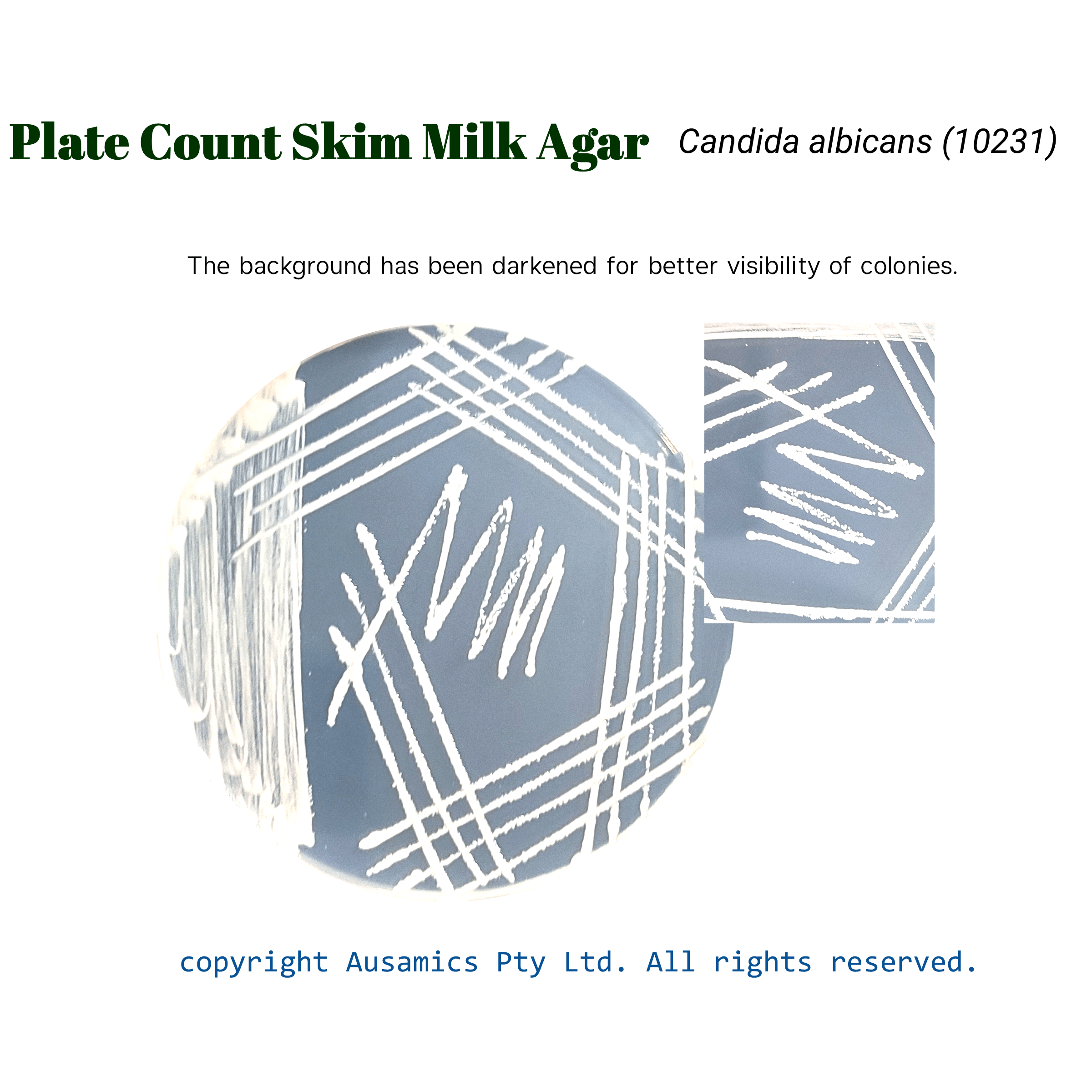 Plate_Count_Skim_Milk_Agar_Candida_albicans(10231)_Ausamics