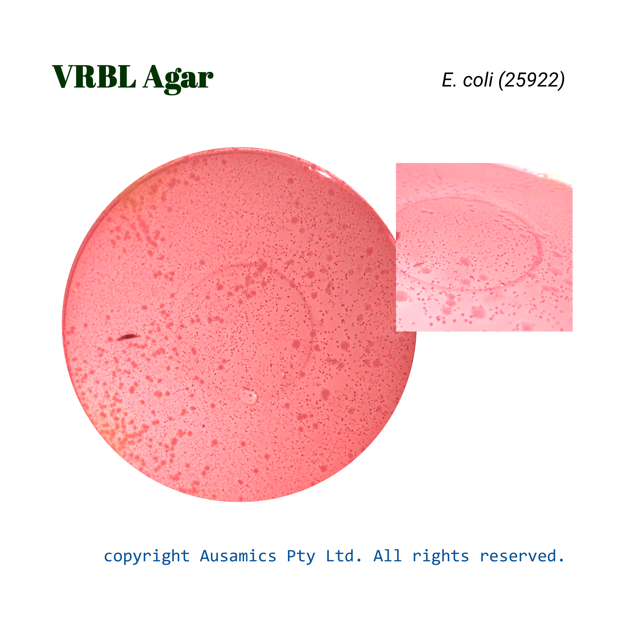 VRBL_Ecoli(25922)_Ausamics