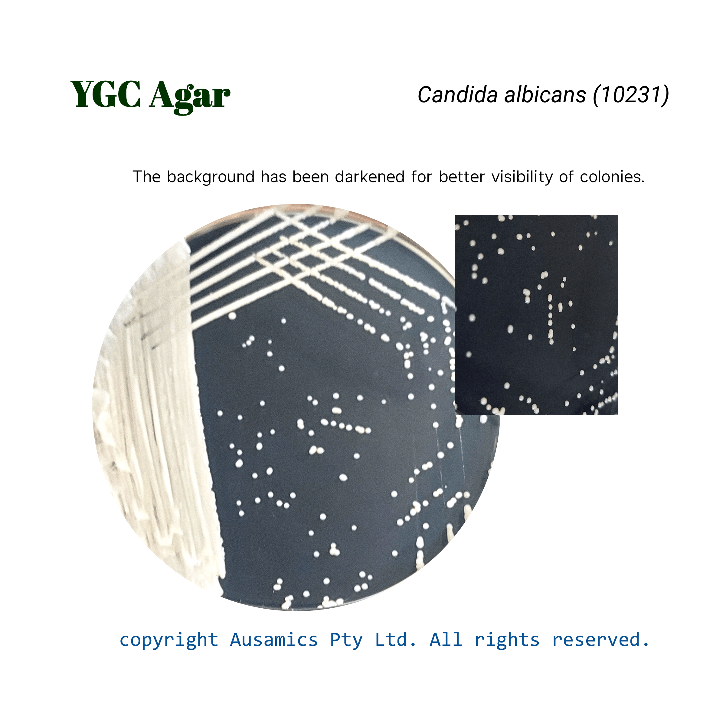 YGC_Candida_albicans(10231)_Ausamics